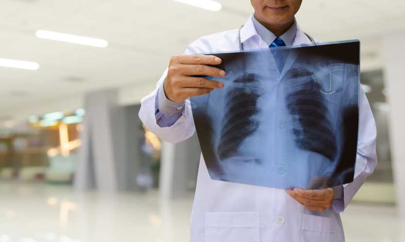 Workplace fumes linked to signs of early lung disease