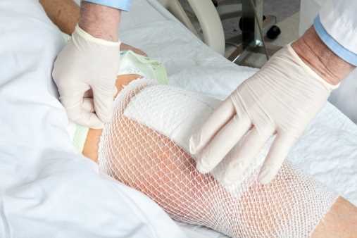 Bundling knee replacement payments could save employers up to 10%: Study