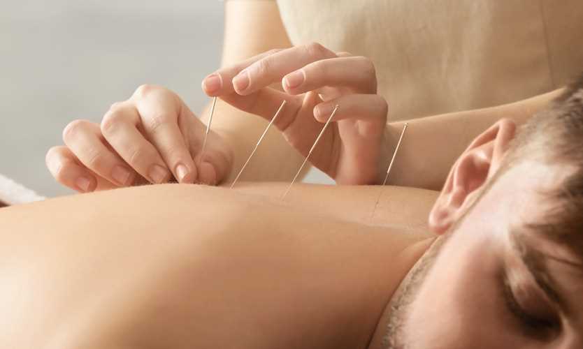 Bill allowing acupuncturists to treat injured workers advances